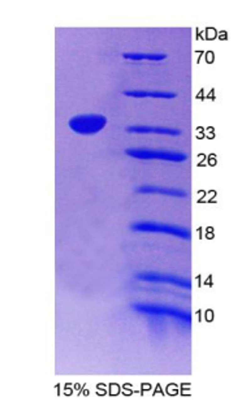 Rat Recombinant Apolipoprotein H (APOH)