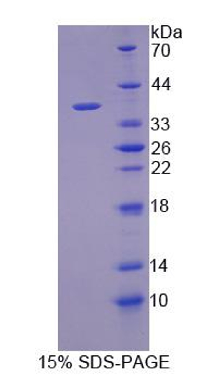 Pig Recombinant Galectin 12 (GAL12)