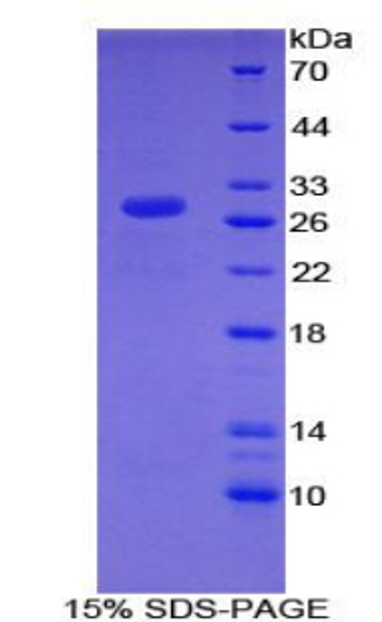 Mouse Recombinant Chromodomain Helicase DNA Binding Protein 3 (CHD3)