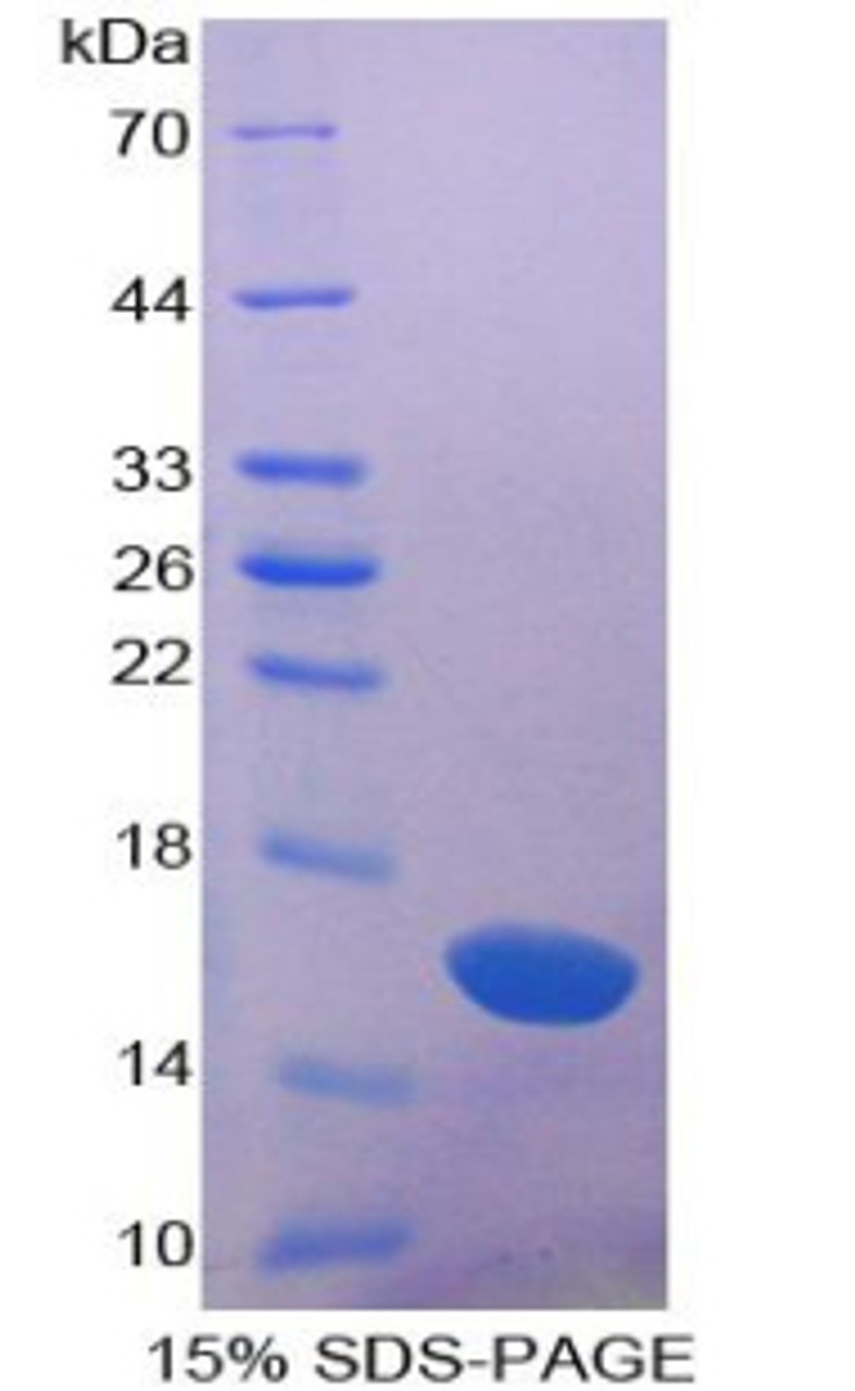 Cattle Recombinant Galectin 1 (GAL1)