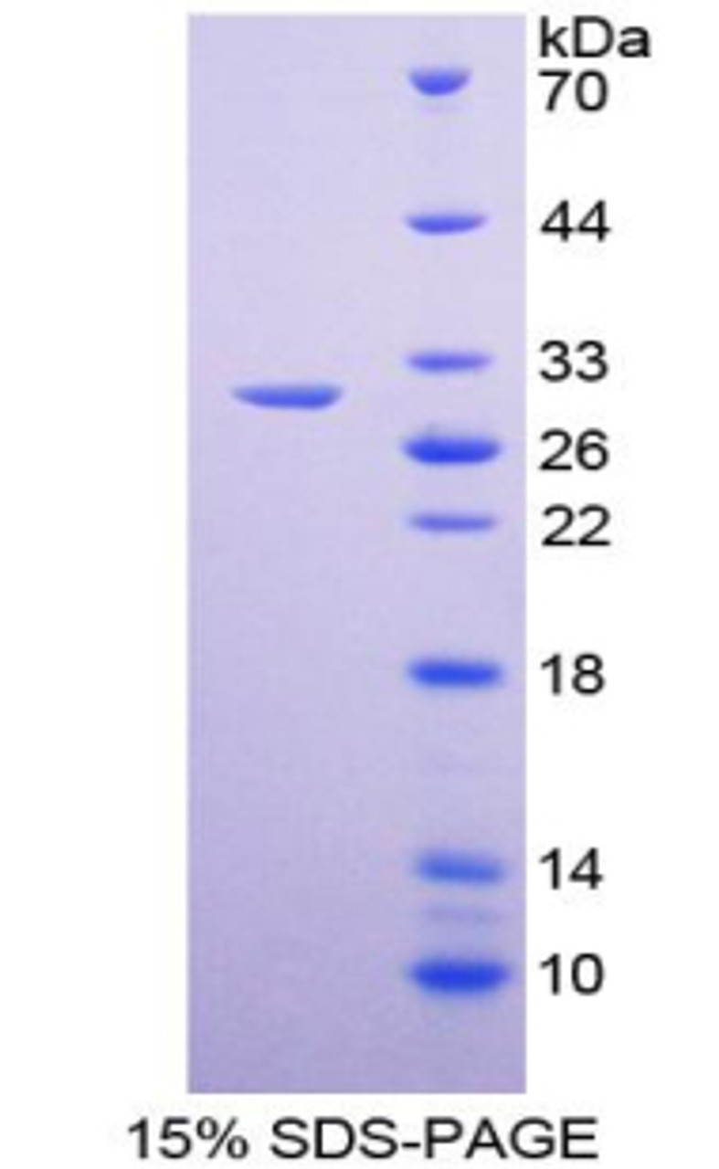 Mouse Recombinant GATA Binding Protein 1 (GATA1)