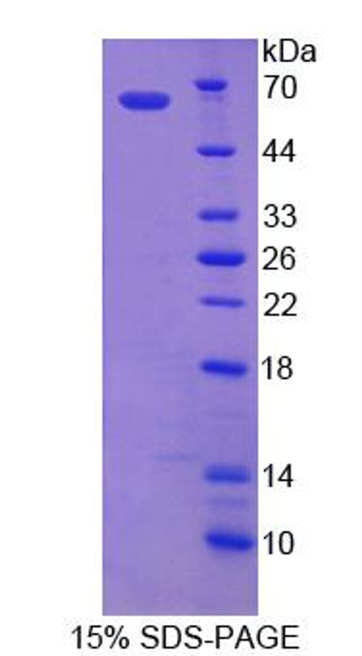 Human Recombinant ATP Binding Cassette Transporter D1 (ABCD1)