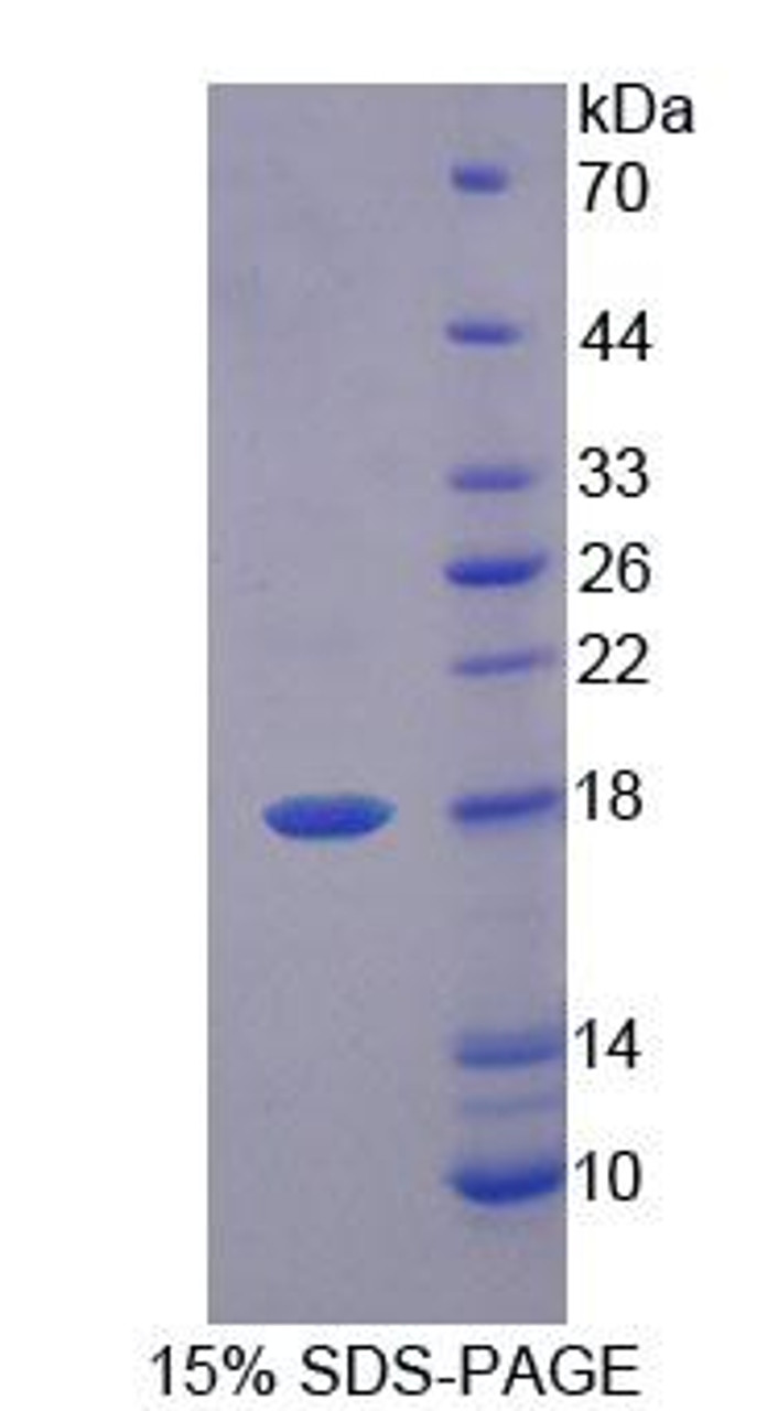 Pig Recombinant Fatty Acid Binding Protein 6, Ileal (FABP6)