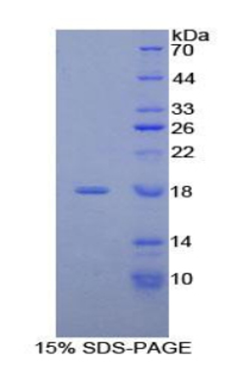 Human Recombinant Acyl Carrier Protein, Mitochondrial (ACP)