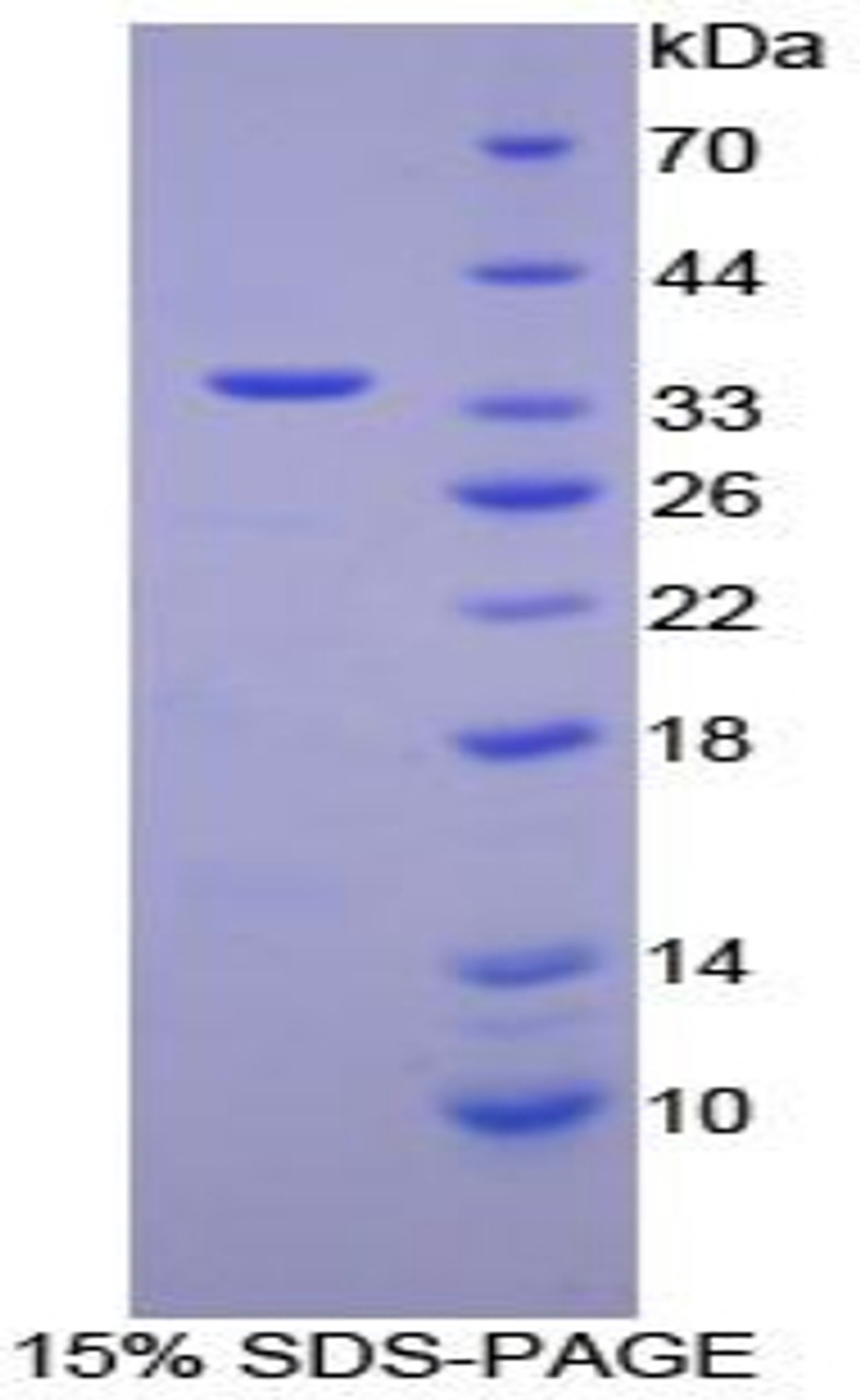 Human Recombinant Retinol Binding Protein 3, Interstitial (RBP3)