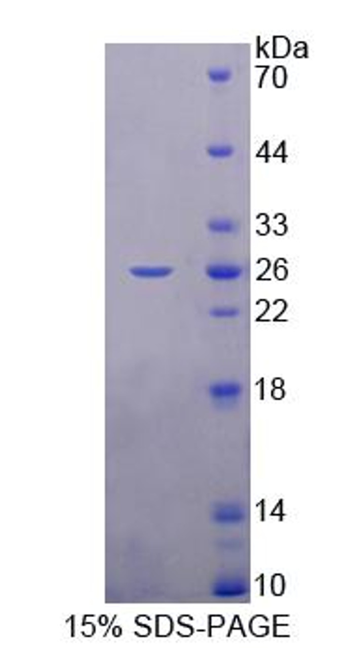 Rat Recombinant Retinol Binding Protein 3, Interstitial (RBP3)