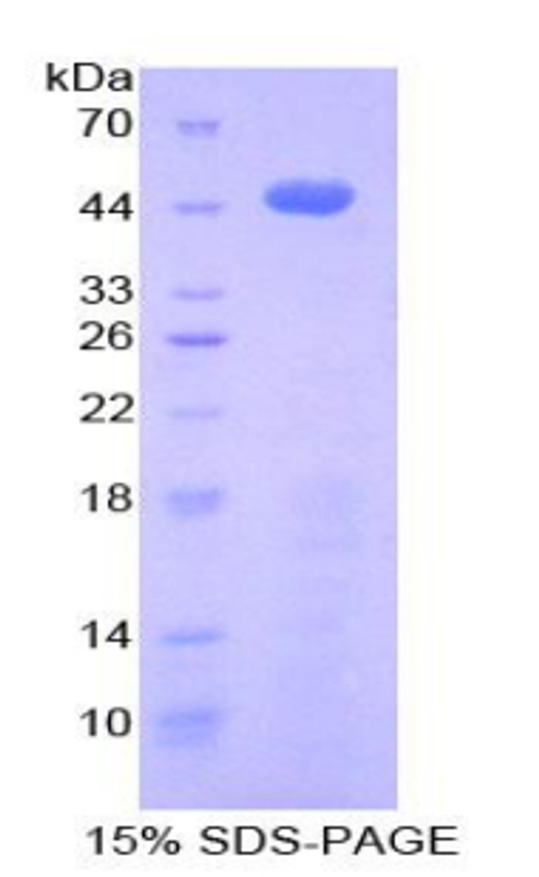 Pig Recombinant Beta-Thromboglobulin (bTG)