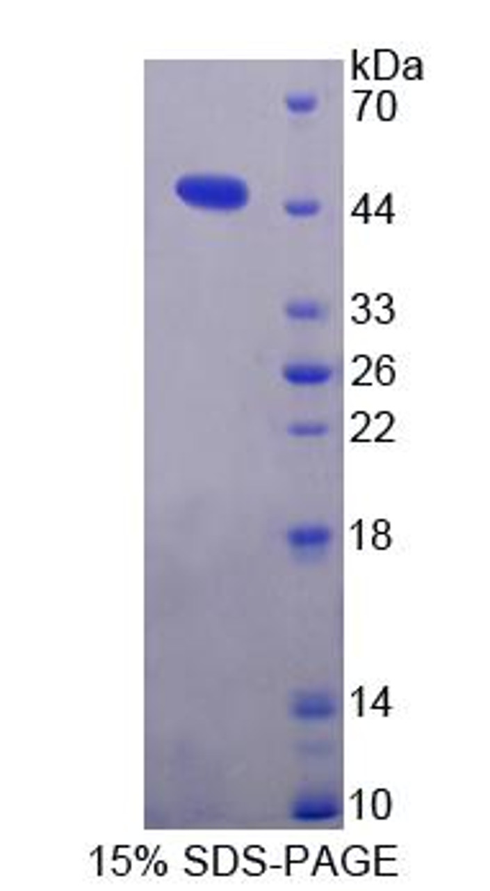 Human Recombinant Gelsolin (GS)