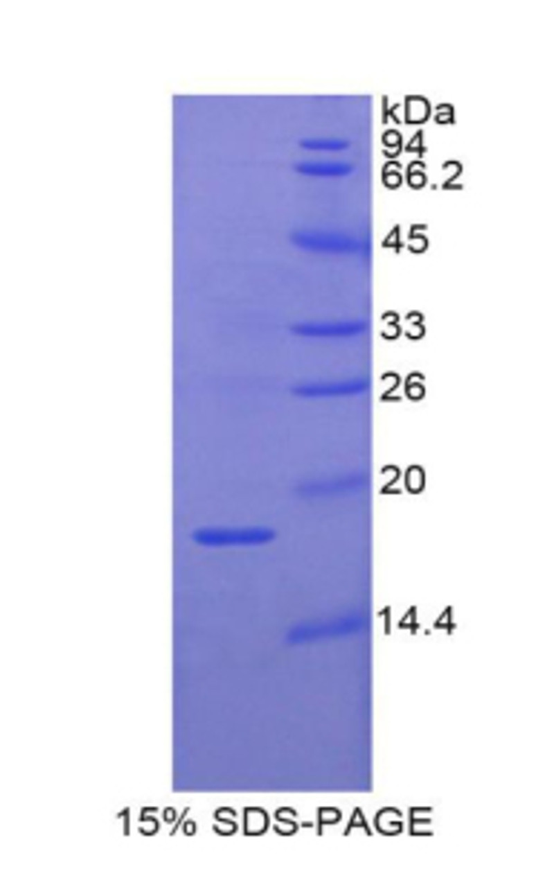 Pig Recombinant Retinol Binding Protein 2, Cellular (RBP2)