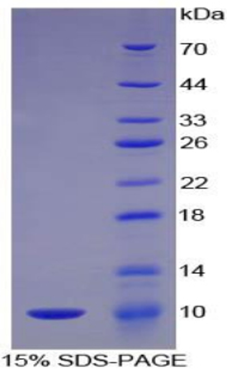 Mouse Recombinant Complement Component 5a (C5a)