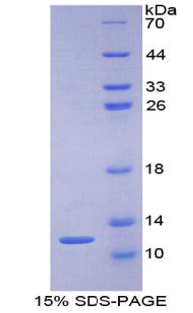 Human Recombinant Protein Kinase Inhibitor Gamma (PKIg)