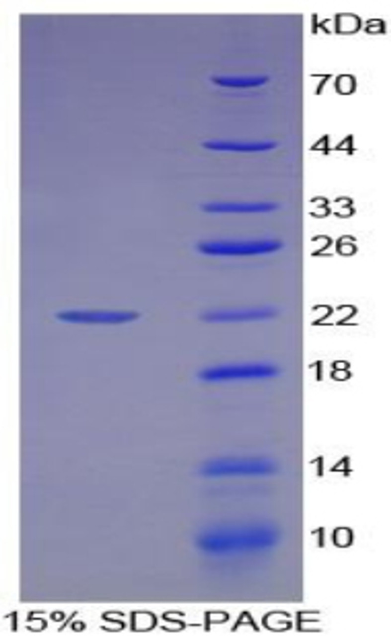 Human Recombinant High Mobility Group Protein 1 (HMG1)