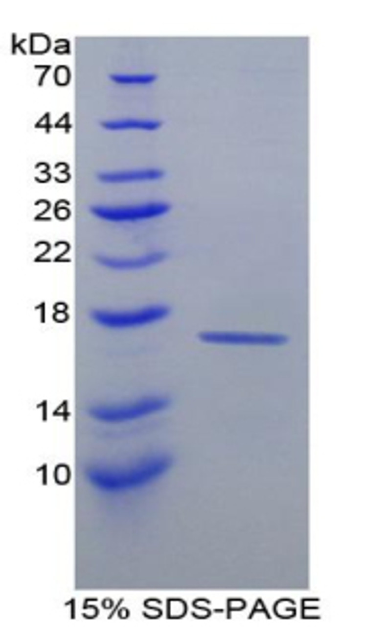 Mouse Recombinant Retinol Binding Protein 1, Cellular (RBP1)