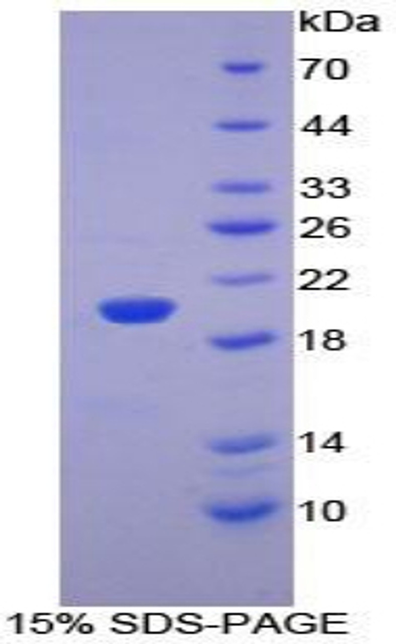 Mouse Recombinant Pleckstrin Homology Like Domain Family A, Member 2 (PHLDA2)