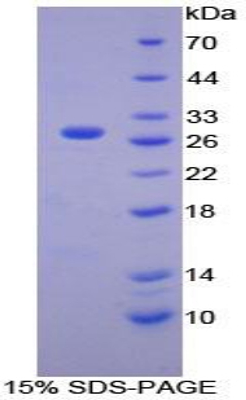 Mouse Recombinant Phospholipase A2, Calcium Independent (iPLA2)