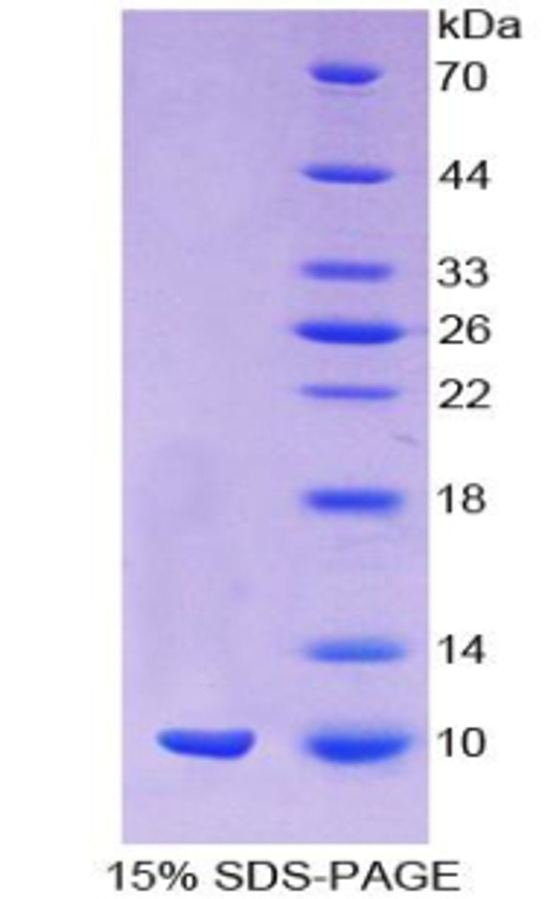 Mouse Recombinant Mucin 1 (MUC1)