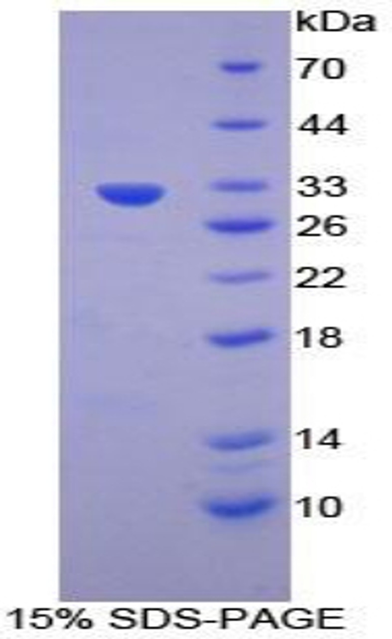 Mouse Recombinant Apoptosis Associated Tyrosine Kinase (AATK)