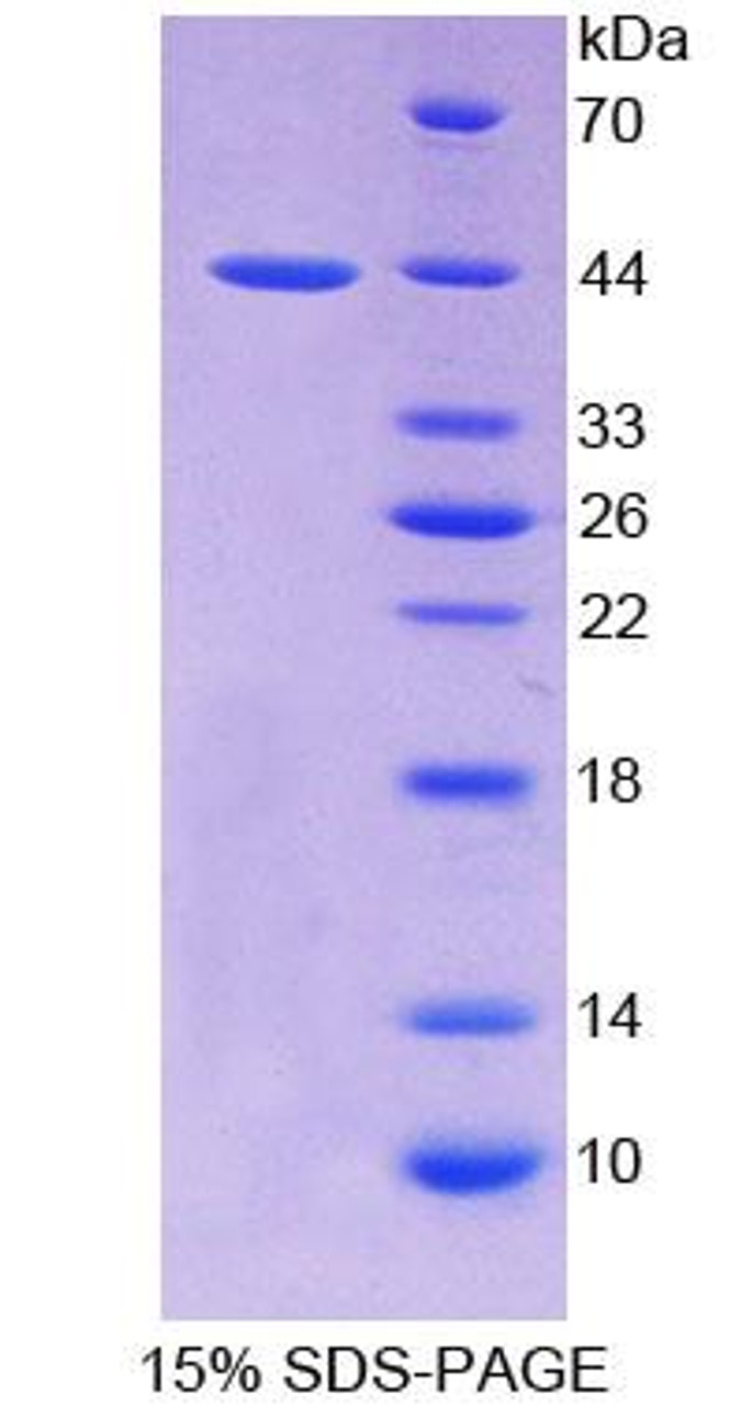 Rat Recombinant Parathyroid Hormone Receptor 2 (PTHR2)