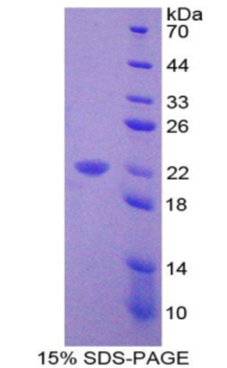 Mouse Recombinant Vitamin D Receptor (VDR)