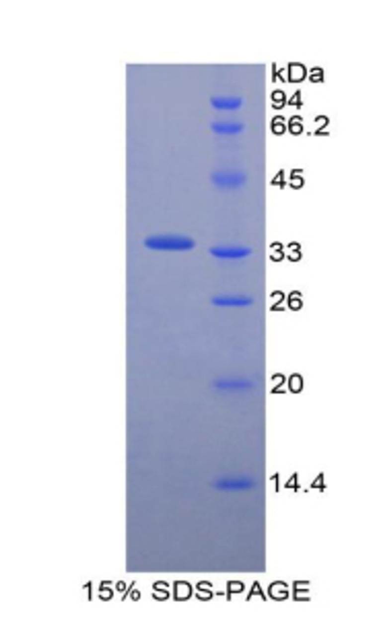 Mouse Recombinant Endothelin Converting Enzyme 1 (ECE1)