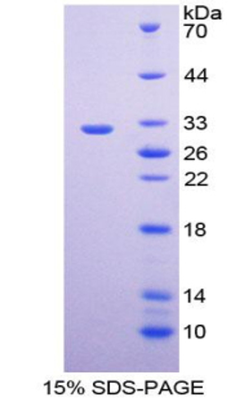 Rat Recombinant Endothelin Converting Enzyme 1 (ECE1)