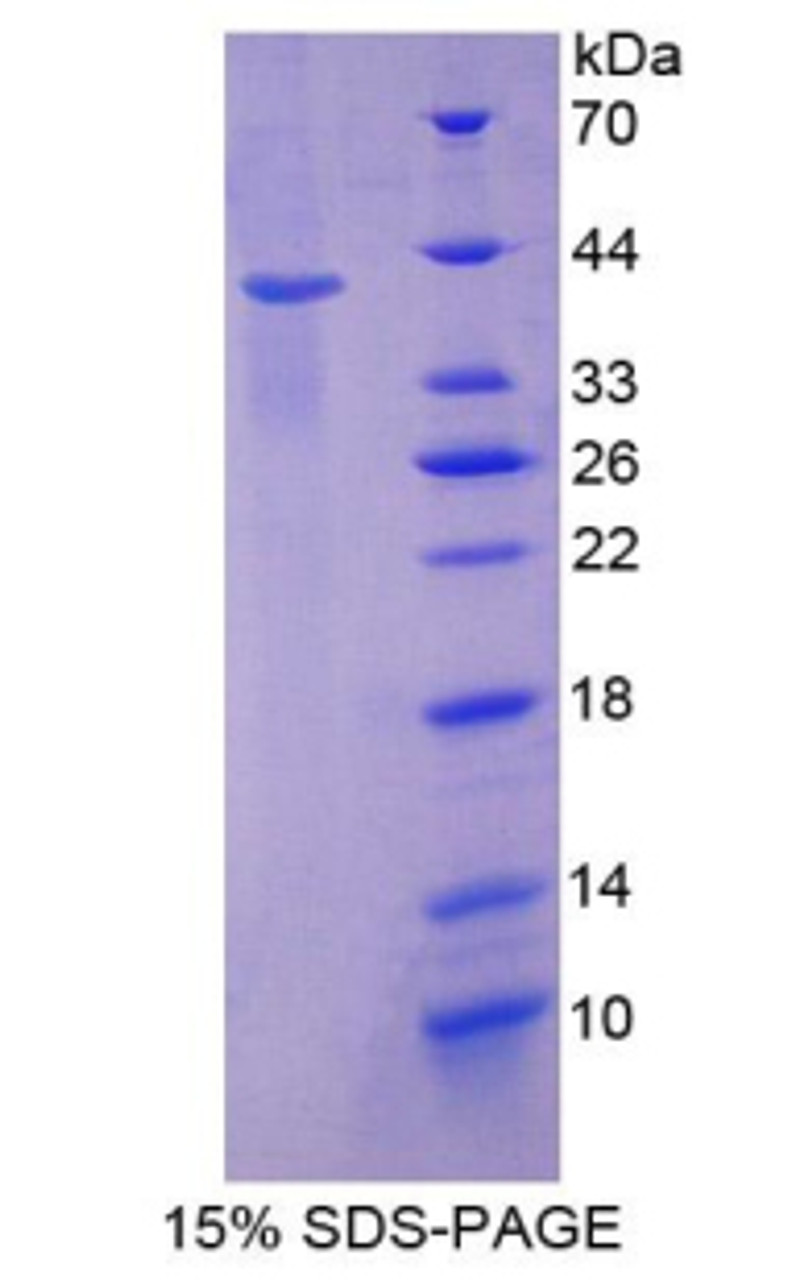 Mouse Recombinant Keratin 2 (KRT2)