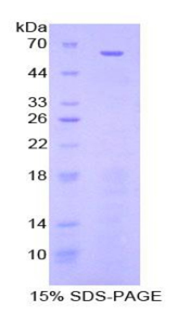 Mouse Recombinant Nestin (NES)