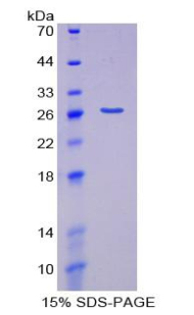 Human Recombinant Coilin (COIL)