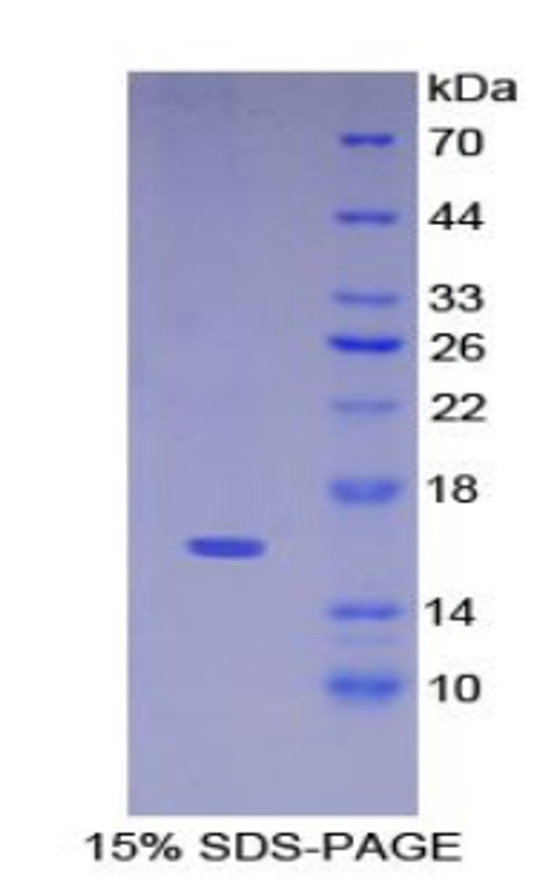 Human Recombinant Keratin 15 (KRT15)