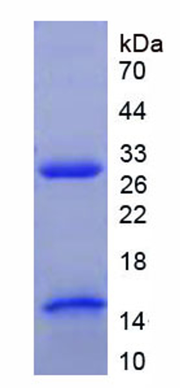 Mouse Recombinant Tissue Factor (TF)