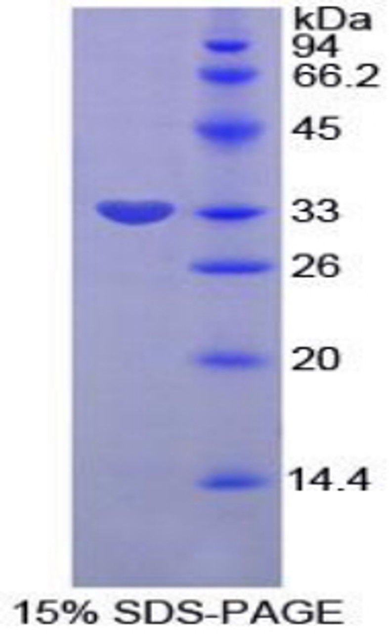 Rat Recombinant Plasminogen Activator Inhibitor 2 (PAI2)