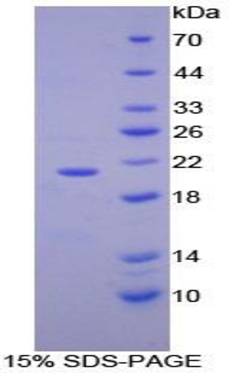 Human Recombinant Vascular Cell Adhesion Molecule 1 (VCAM1)