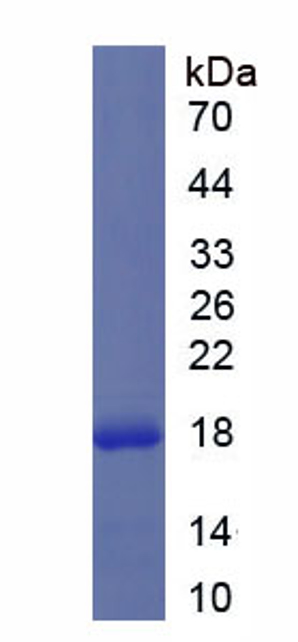 Human Recombinant Interleukin 1 Delta (FIL1d)