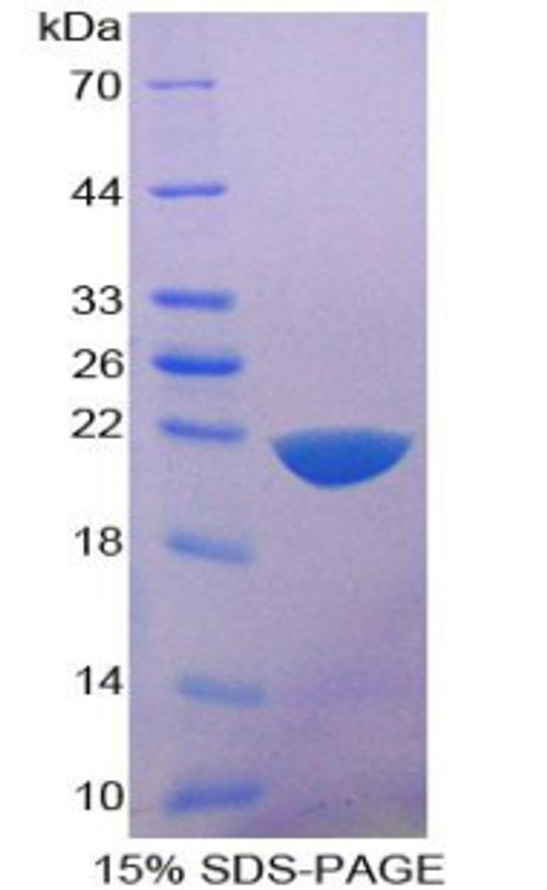 Mouse Recombinant Interleukin 1 Delta (FIL1d)