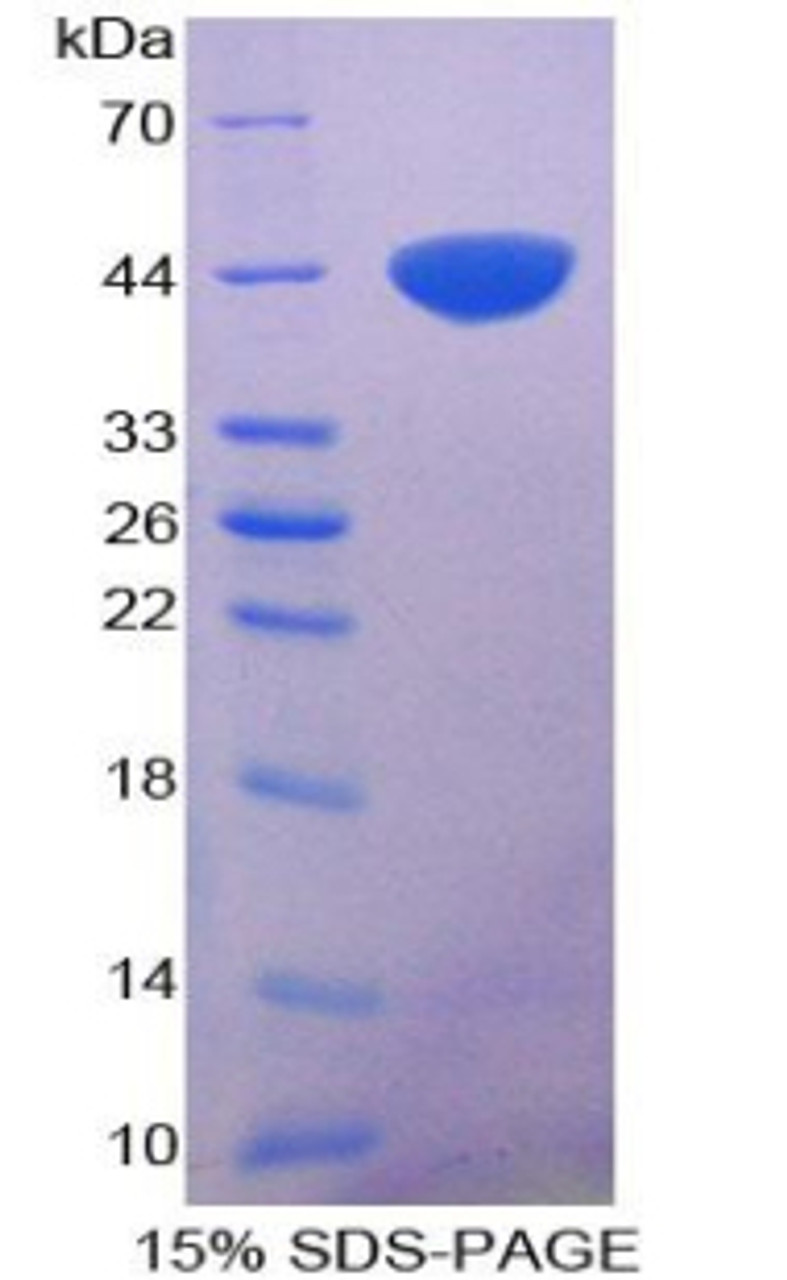 Chicken Recombinant S100 Calcium Binding Protein A11 (S100A11)