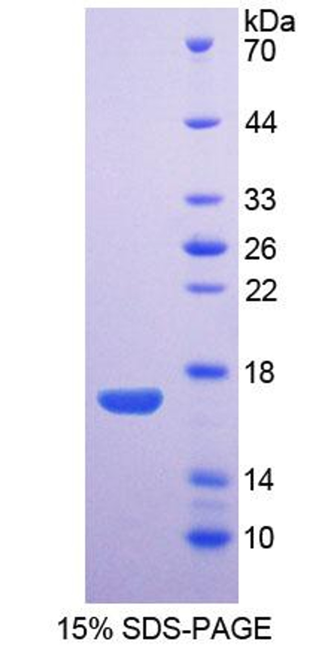 Rabbit Recombinant Aquaporin 1, Colton Blood Group (AQP1)