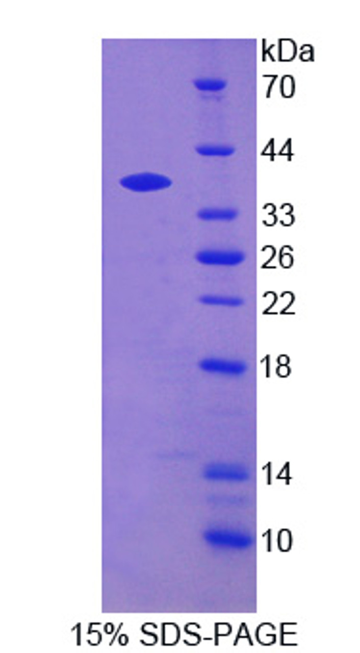 Cattle Recombinant Heme Oxygenase 1, Decycling (HO1)