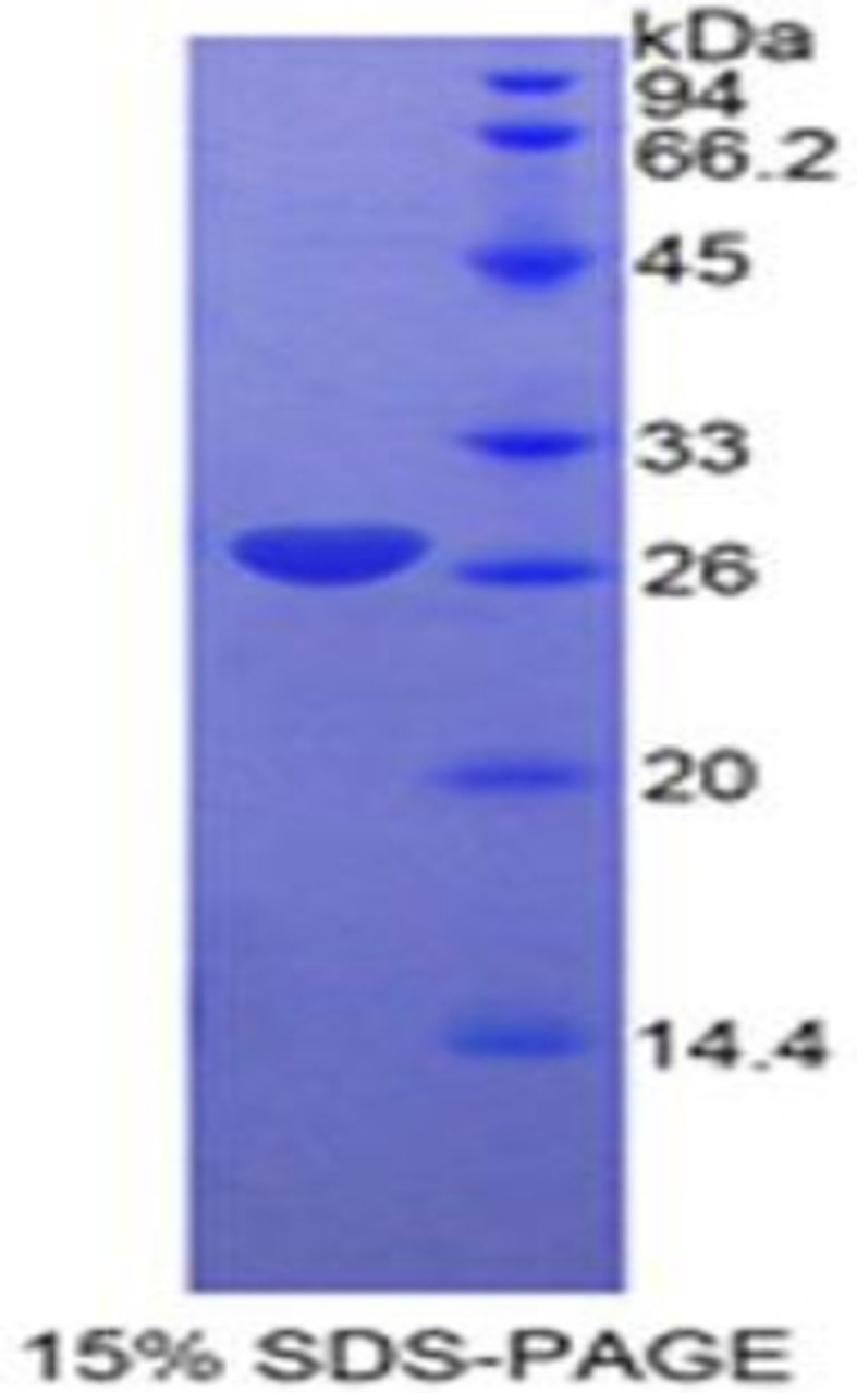 Cattle Recombinant Cyclin D1 (CCND1)