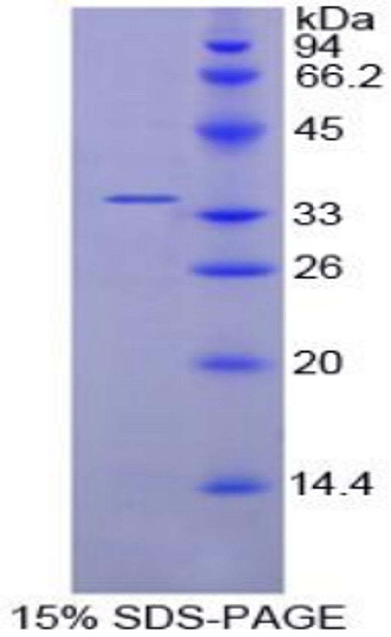 Chicken Recombinant Cyclin D1 (CCND1)