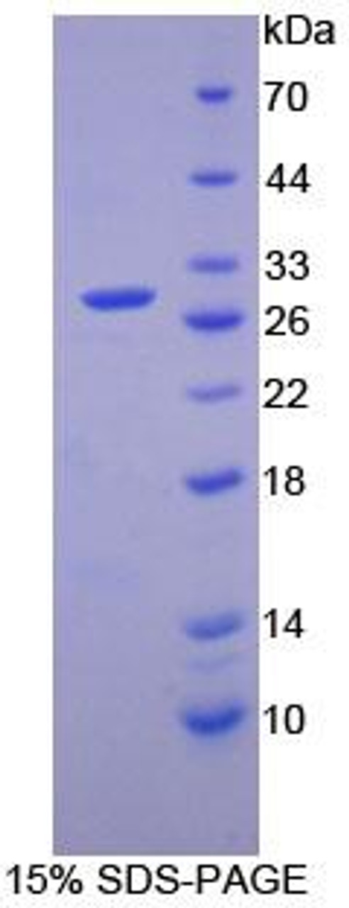 Human Recombinant Cyclin D2 (CCND2)