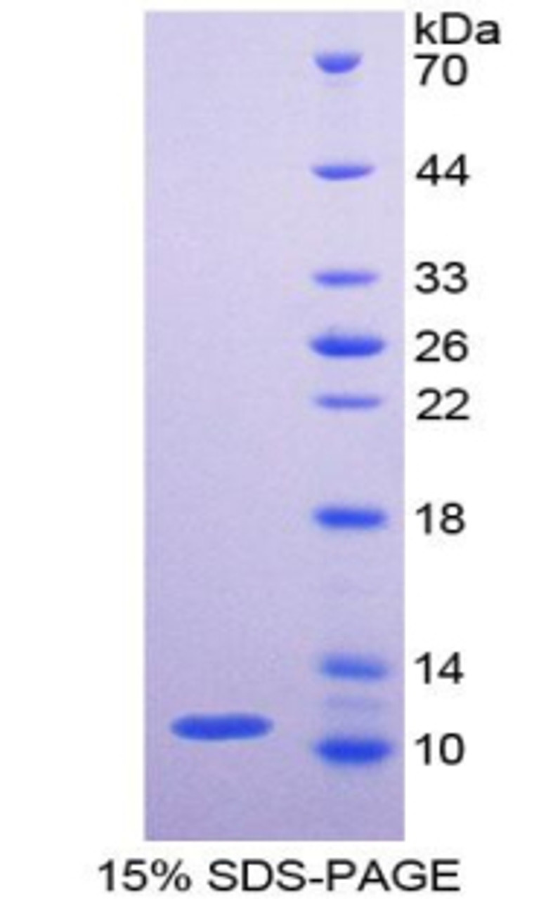 Human Recombinant Pyruvate Kinase, Muscle (PKM2)