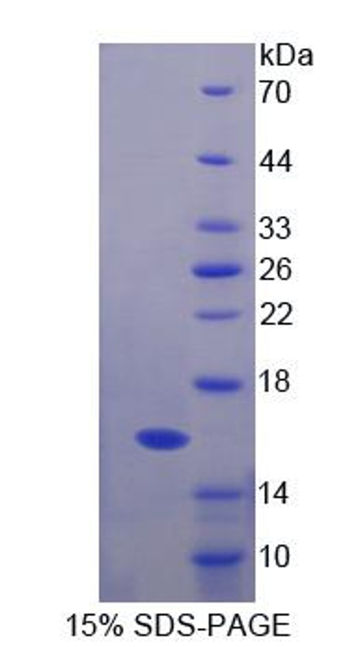 Human Recombinant Fibrillin 1 (FBN1)