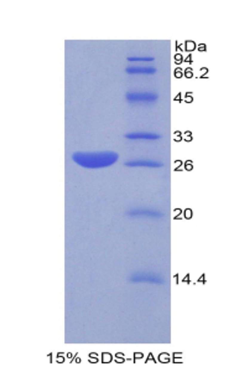 Mouse Recombinant Glutathione S Transferase Alpha 1 (GSTa1)