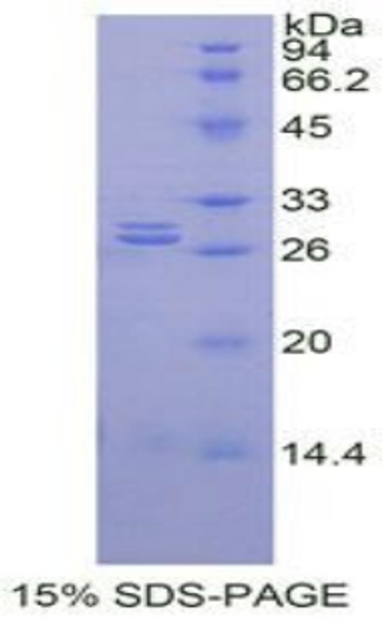 Rat Recombinant Glutathione S Transferase Alpha 1 (GSTa1)