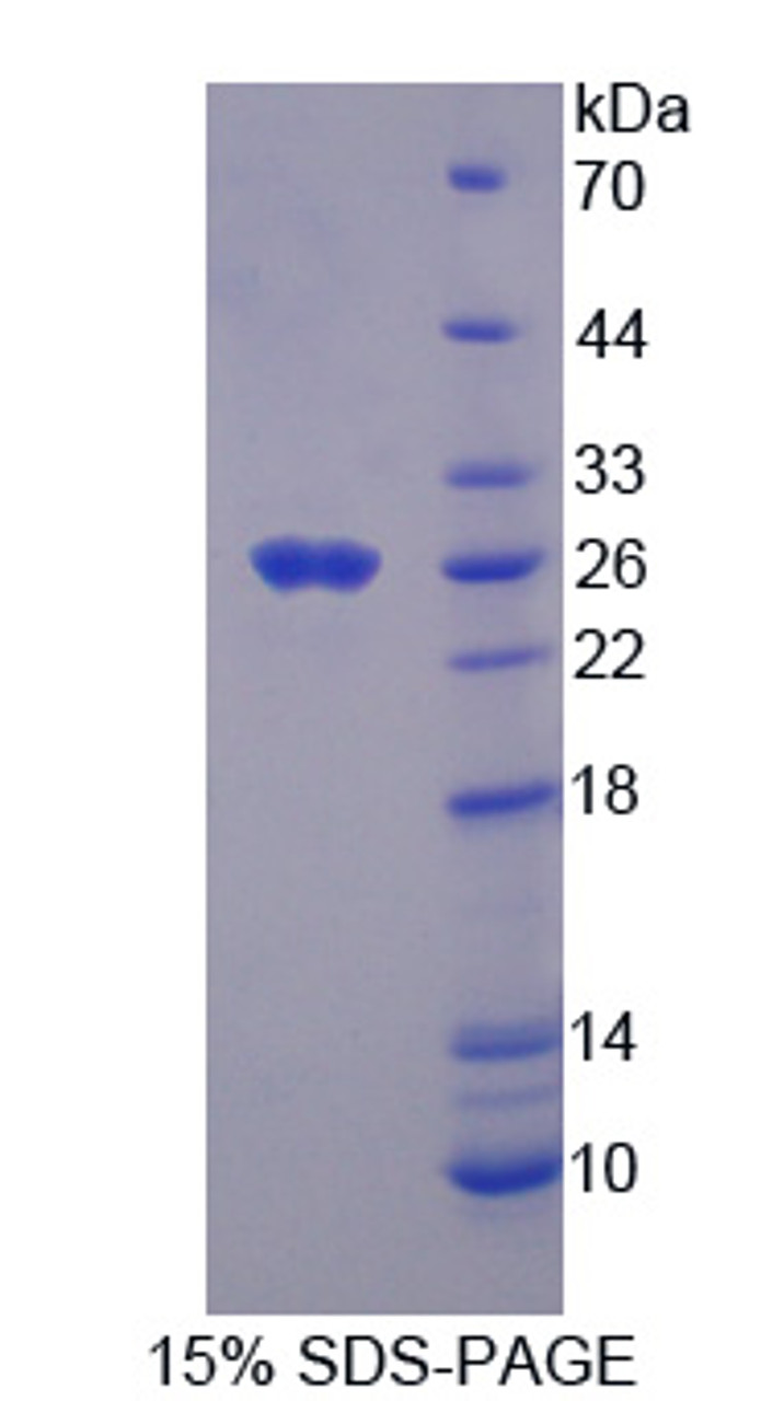 Cattle Recombinant Thrombospondin 1 (THBS1)