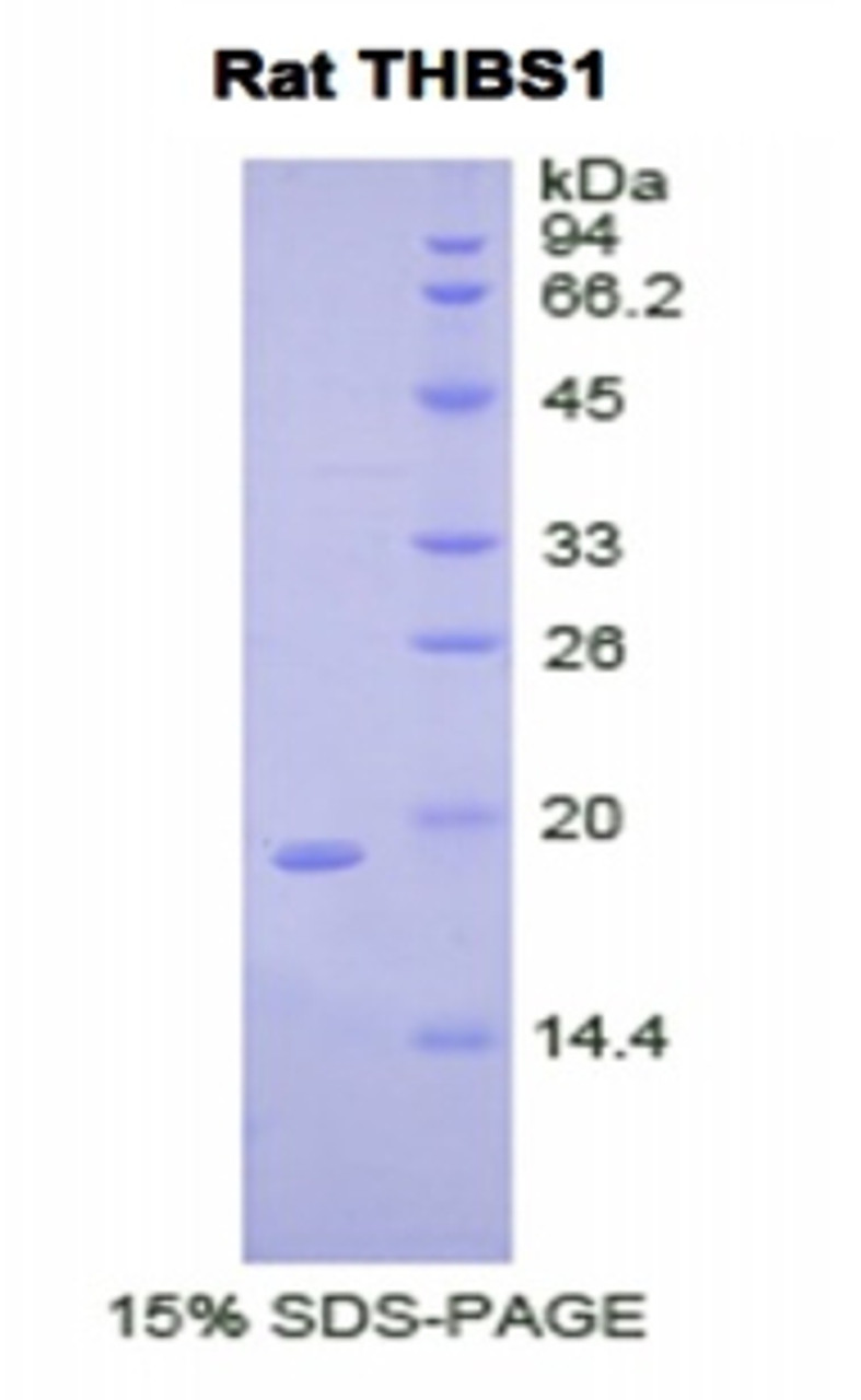 Rat Recombinant Thrombospondin 1 (THBS1)