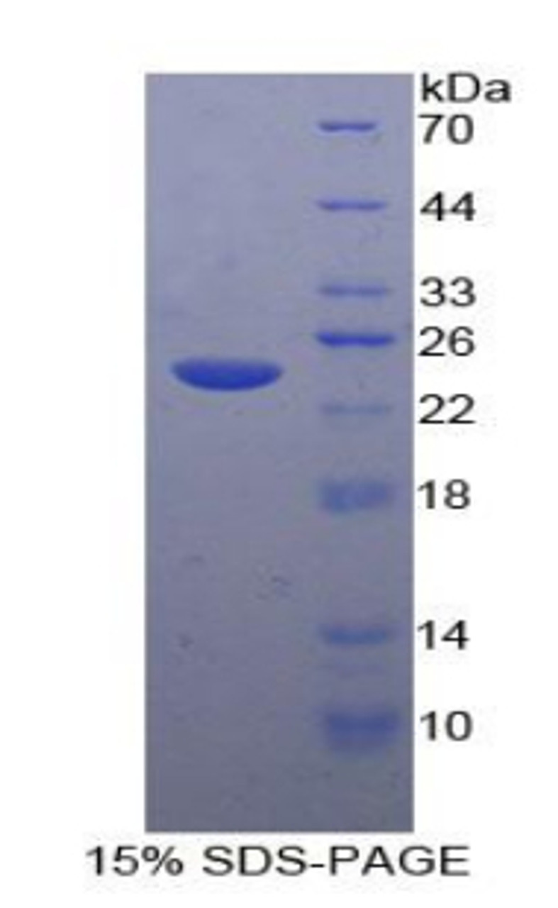 Human Recombinant Tachykinin Receptor 2 (TACR2)