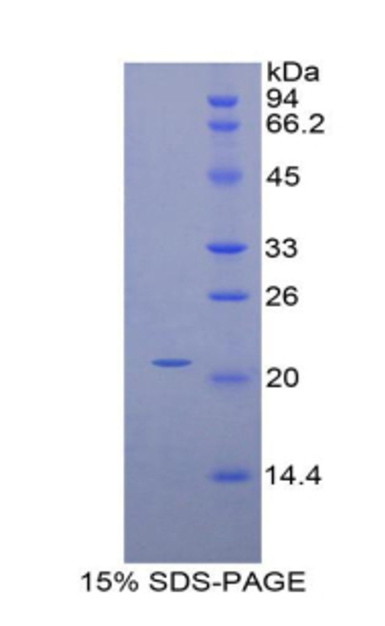 Mouse Recombinant Hepatoma Derived Growth Factor (HDGF)