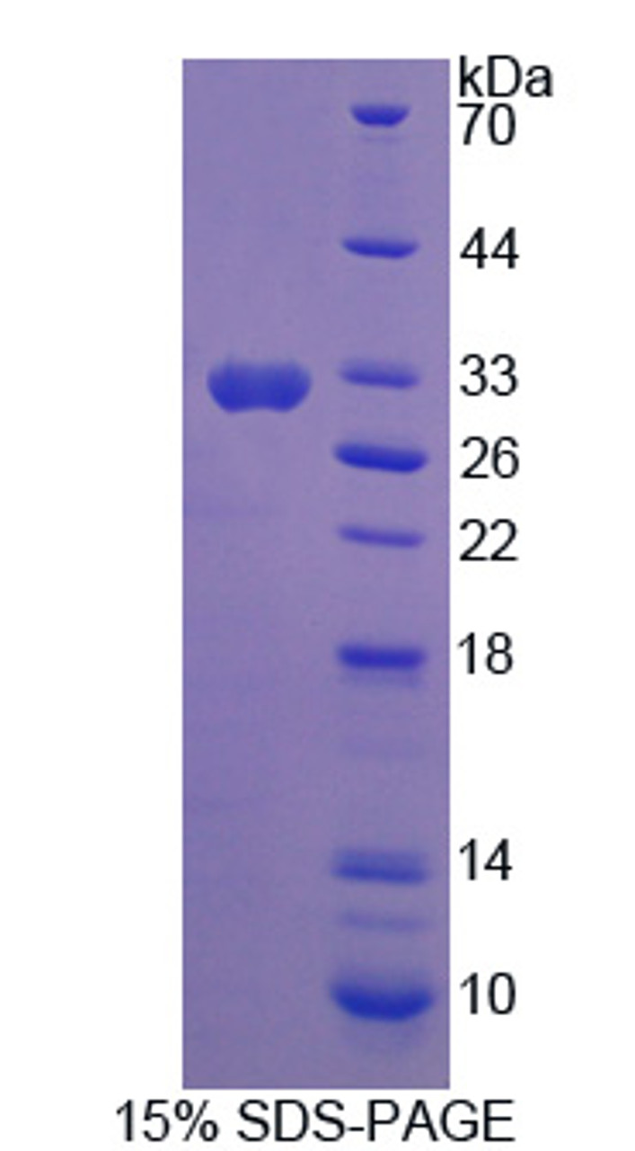 Rat Recombinant Nitric Oxide Synthase Trafficker (NOSTRIN)