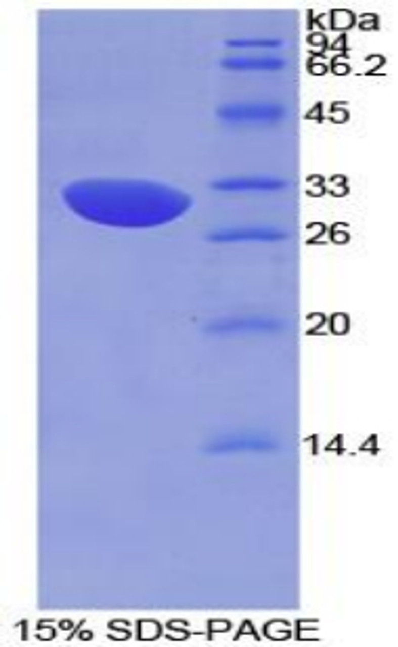 Mouse Recombinant Complement Factor H (CFH)